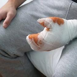 Татарстанцу оторвало палец, после аварии: версия случившегося