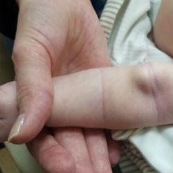 В Казани провели первую в мире уникальную операцию двухмесячной малышке